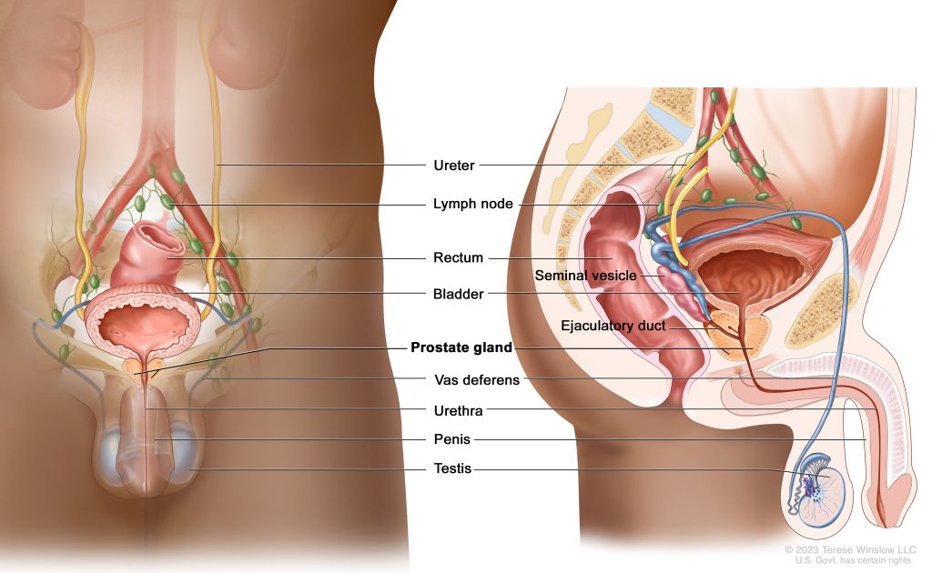 Prostate Cancer